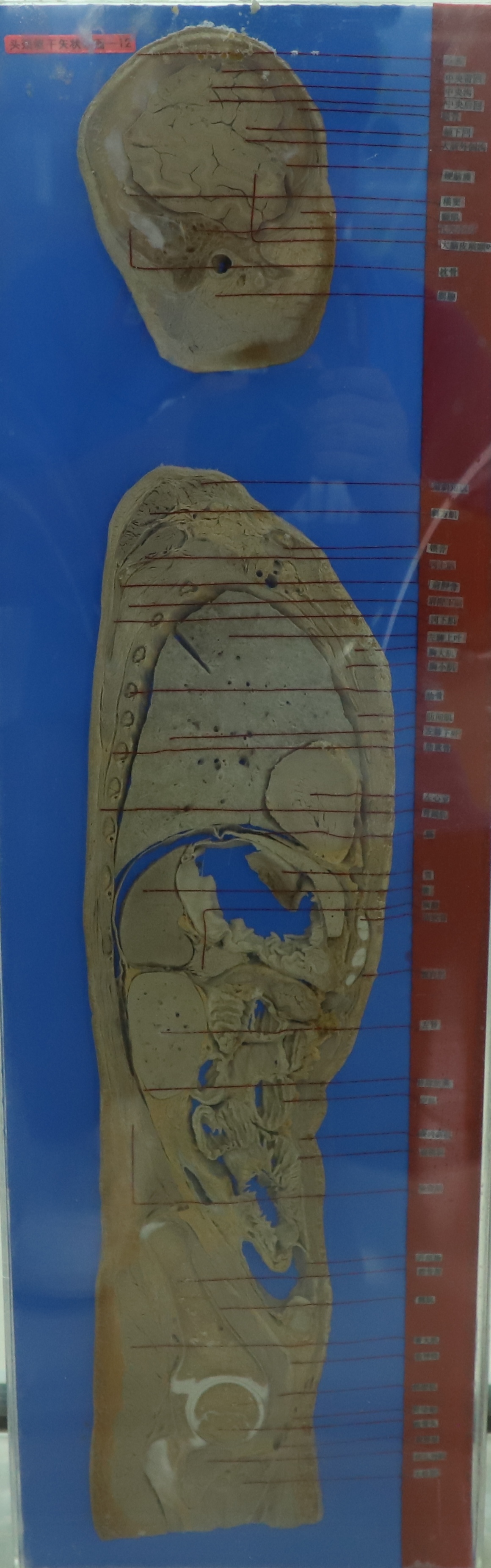 頭頸軀干矢狀斷面