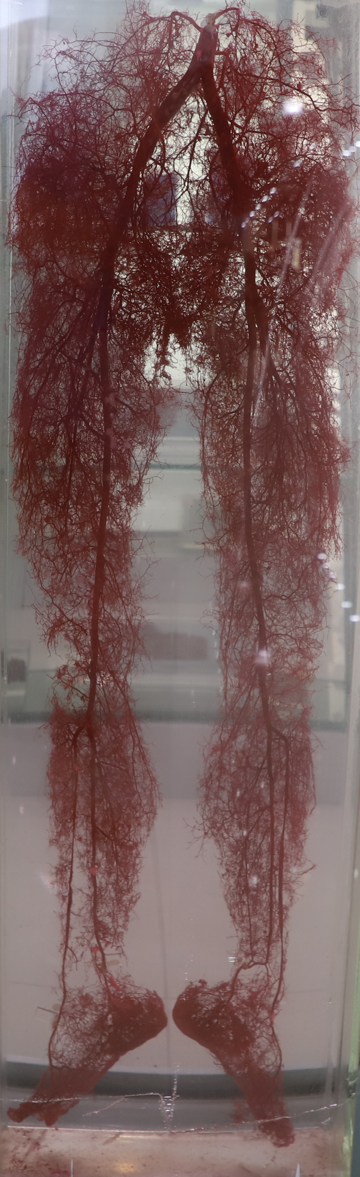 下肢血管鑄型標(biāo)本