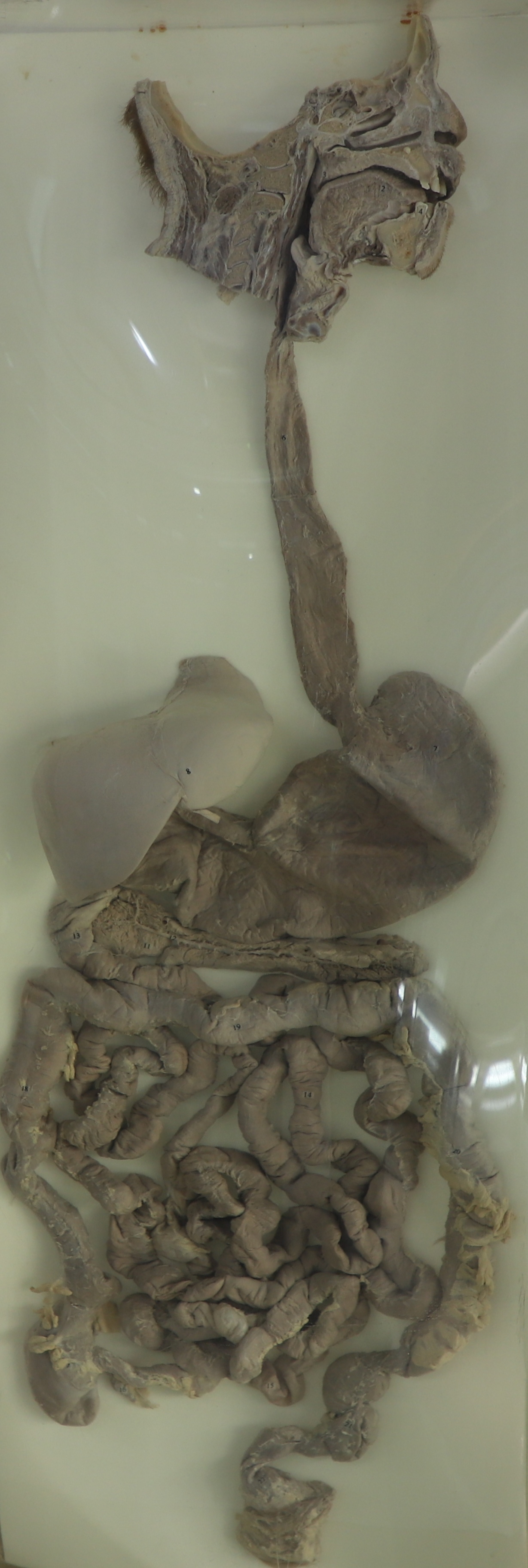 消化系統(tǒng)大體標(biāo)本